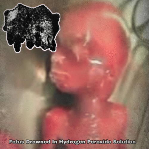 Fetus Demersus : Fetus Drowned in Hydrogen Peroxide Solution